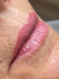 Lippen Nachher 1