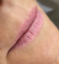 Lippen Vorher 1